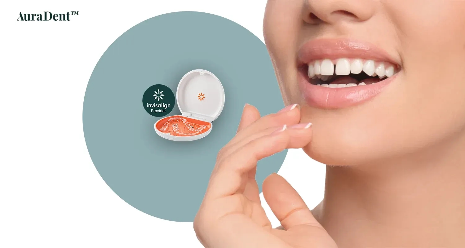 Invisalign for Gapped Teeth