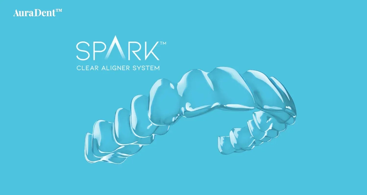 What are Spark Aligners