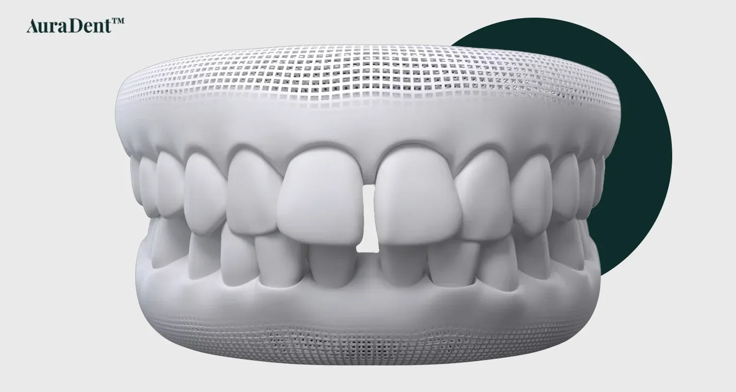 Why Do Gaps Between Teeth Develop