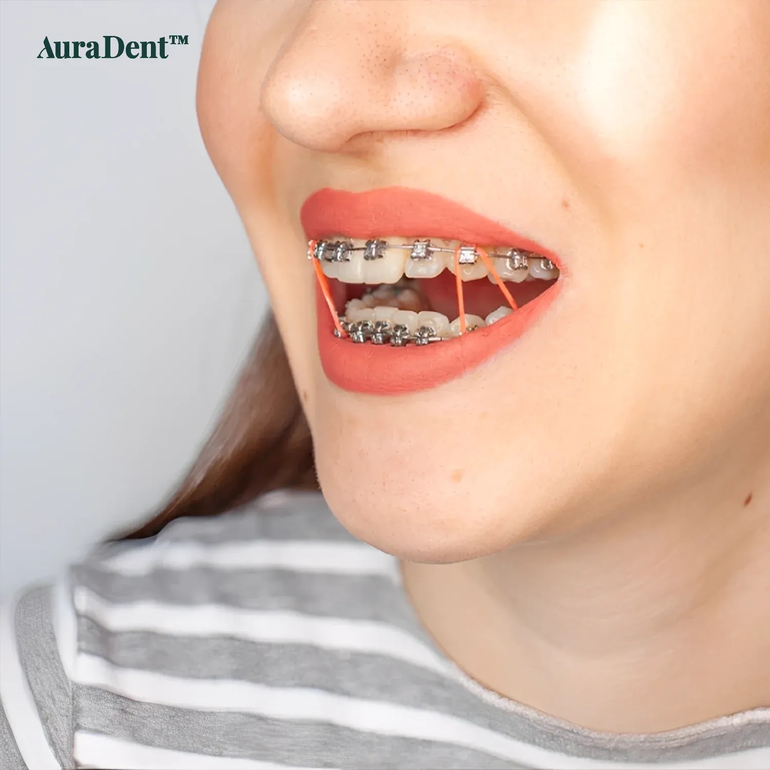 rubber bands for braces poster