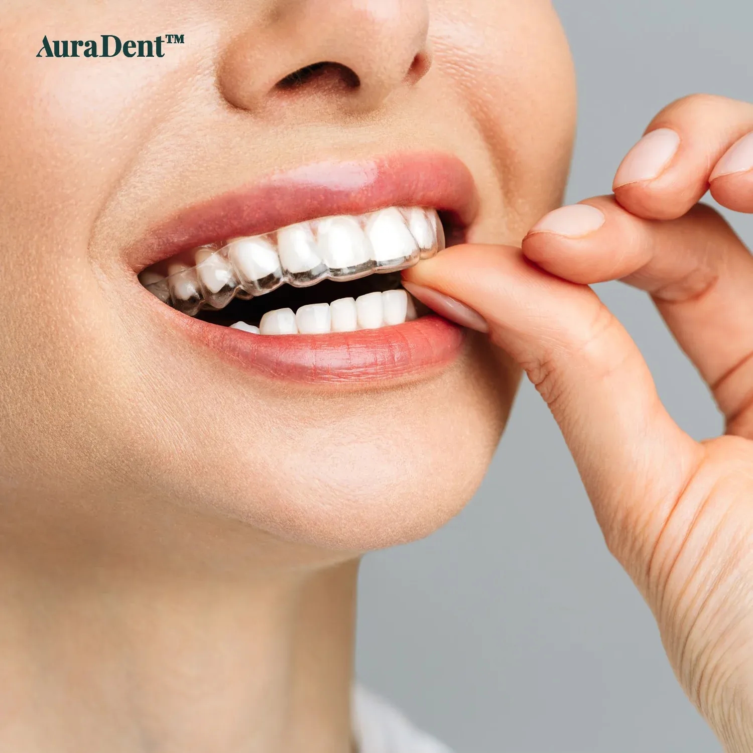 types of braces poster
