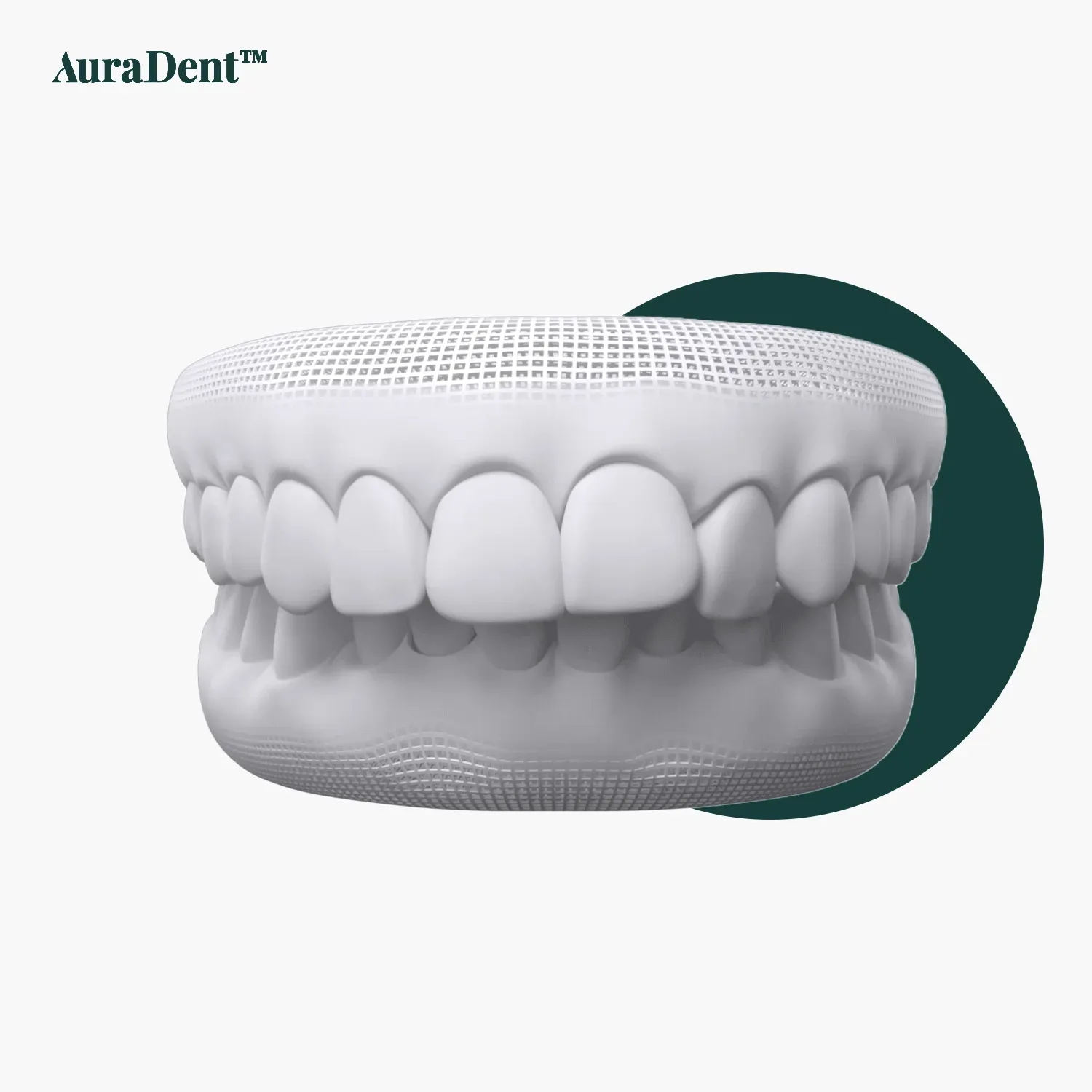 understanding overbite